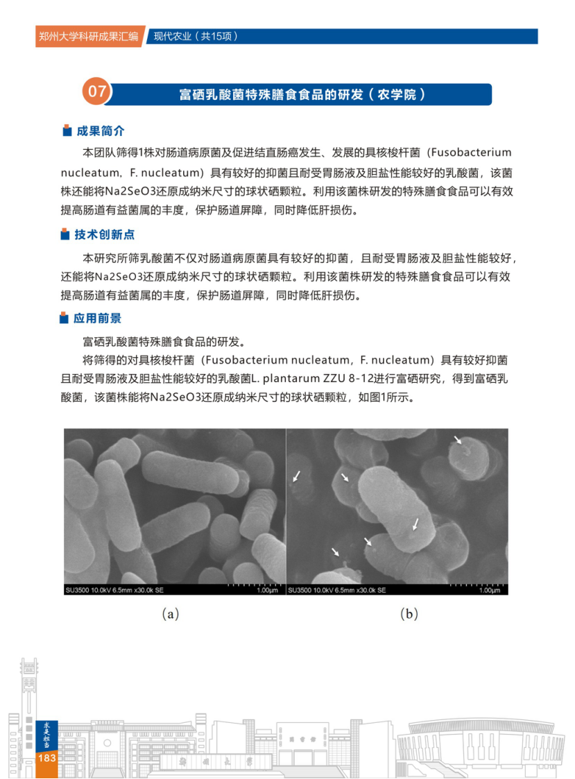 7.富硒乳酸菌特殊膳食食品的研发(郑州大学农学院) .png